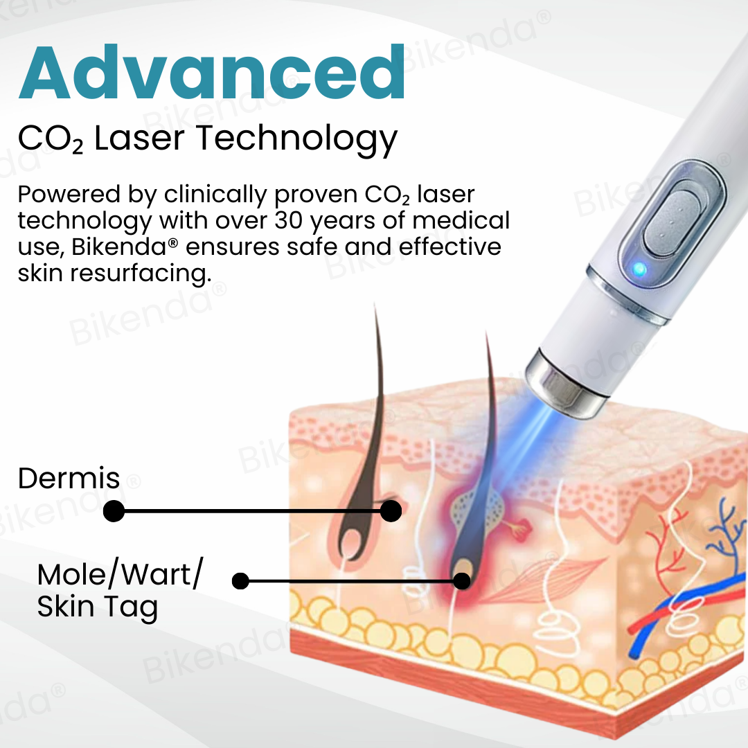 Bikenda® Non-invasive Mole and Wart ✅ 𝕤𝕒𝕧𝕖 𝕦𝕡 𝕥𝕠 𝟟𝟘% Removal Laser Pen