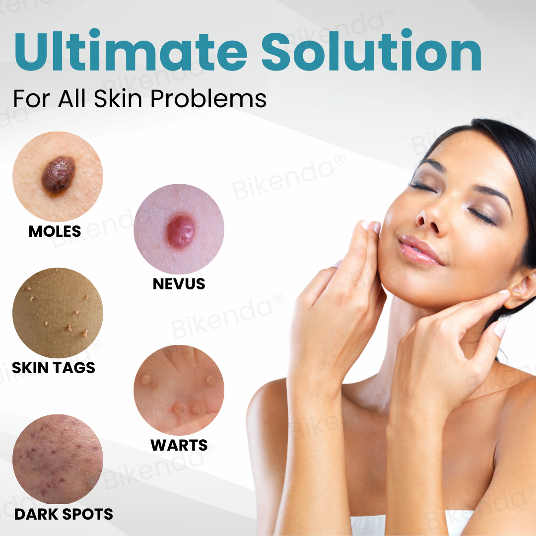 Bikenda® Non-invasive Mole and Wart ✅ 𝕤𝕒𝕧𝕖 𝕦𝕡 𝕥𝕠 𝟟𝟘% Removal Laser Pen