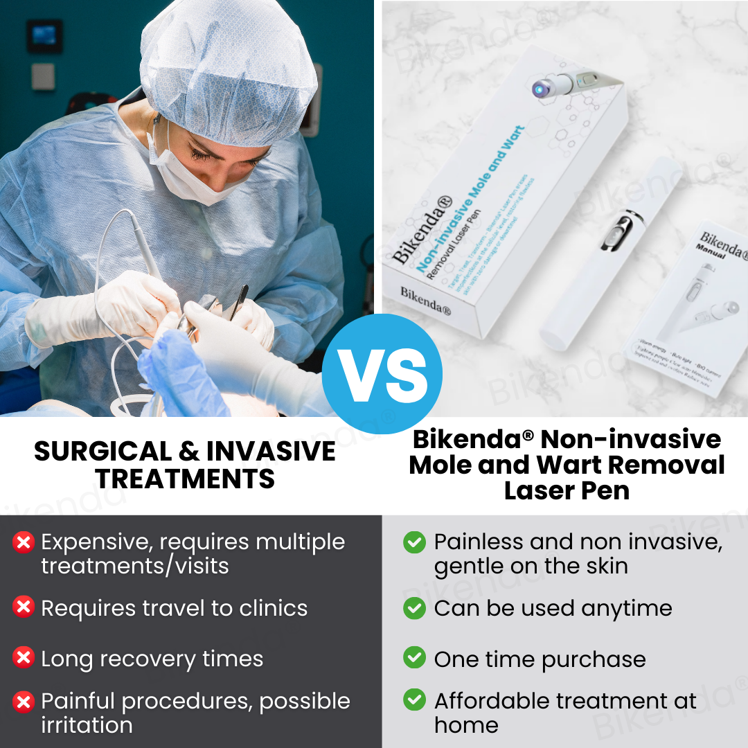 Bikenda® Non-invasive Mole and Wart ✅ 𝕤𝕒𝕧𝕖 𝕦𝕡 𝕥𝕠 𝟟𝟘% Removal Laser Pen