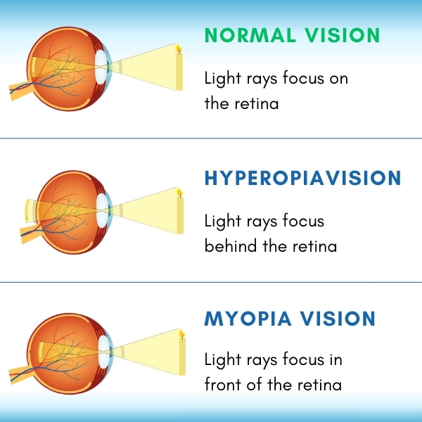 VizoClear™ Daily Liquid Lens - 👩⚕️ Recommended by Experts! 🔥 30-Days Money-Back Guarantee! 💰