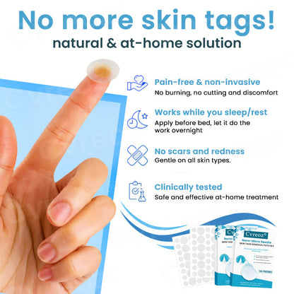 29 Pcs Left!!!Cvreoz® Nano-Micro Needle Skin Tags Removal Patches  | No More Hiding that Skin!💕