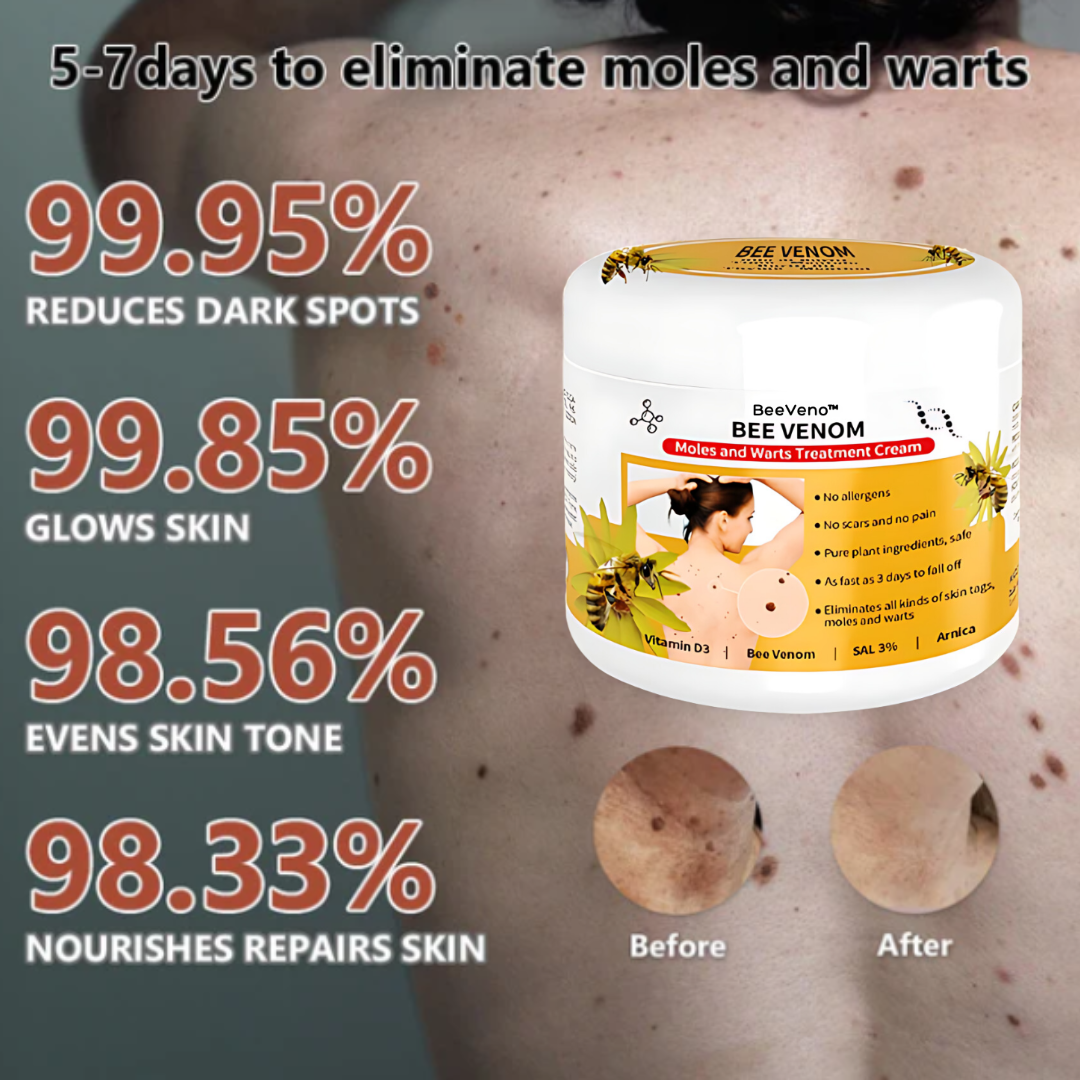 Cvreoz® Bee Venom Mole and Wart Treatment Cream - LIMITED-TIME OFFER | Let out the Best Confidence in YOU!💕