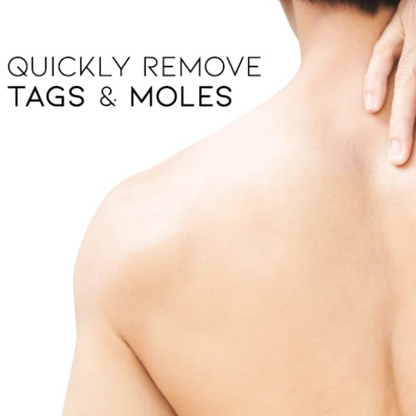 Cvreoz® Bee Venom Mole and Wart Treatment Cream - LIMITED-TIME OFFER | Let out the Best Confidence in YOU!💕