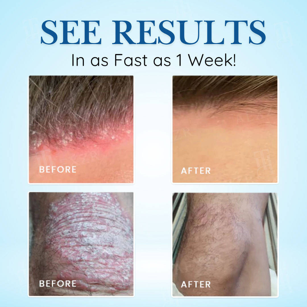 ✨Limited-Time 50% OFF Deal |  Get Calm & Comfort for Less | Cvreoz® Source-Relief Magnesium Spray