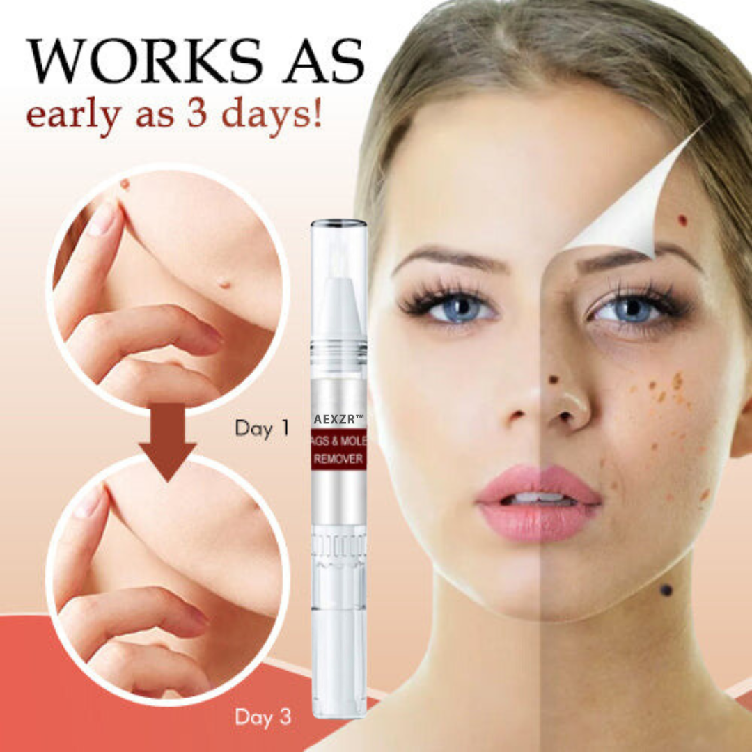 🎁🎁LIMITED DISCOUNT UP TO 50% OFF🎁AEXZR™ Tags & Moles Remover