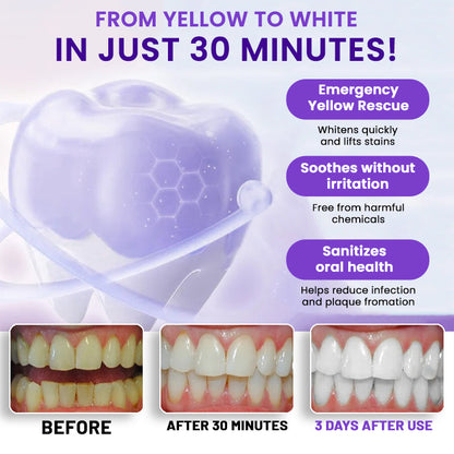 🔥LOWEST PRICE - 50% OFF | AEXZR® V34 Whitening Strips