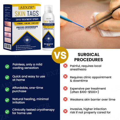 🔥Warts No More - 50% OFF | AEXZR® Skin Tag Cryo Treatment Spray