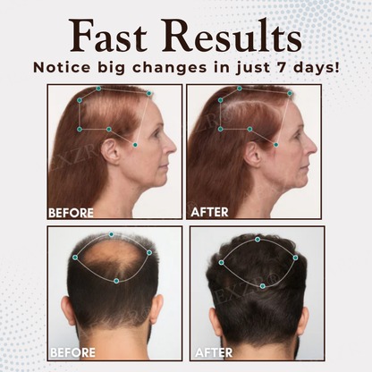 AEXZR® Hair Regrowth Capsules - LIMITED-TIME OFFER | No More Hair loss now!💕