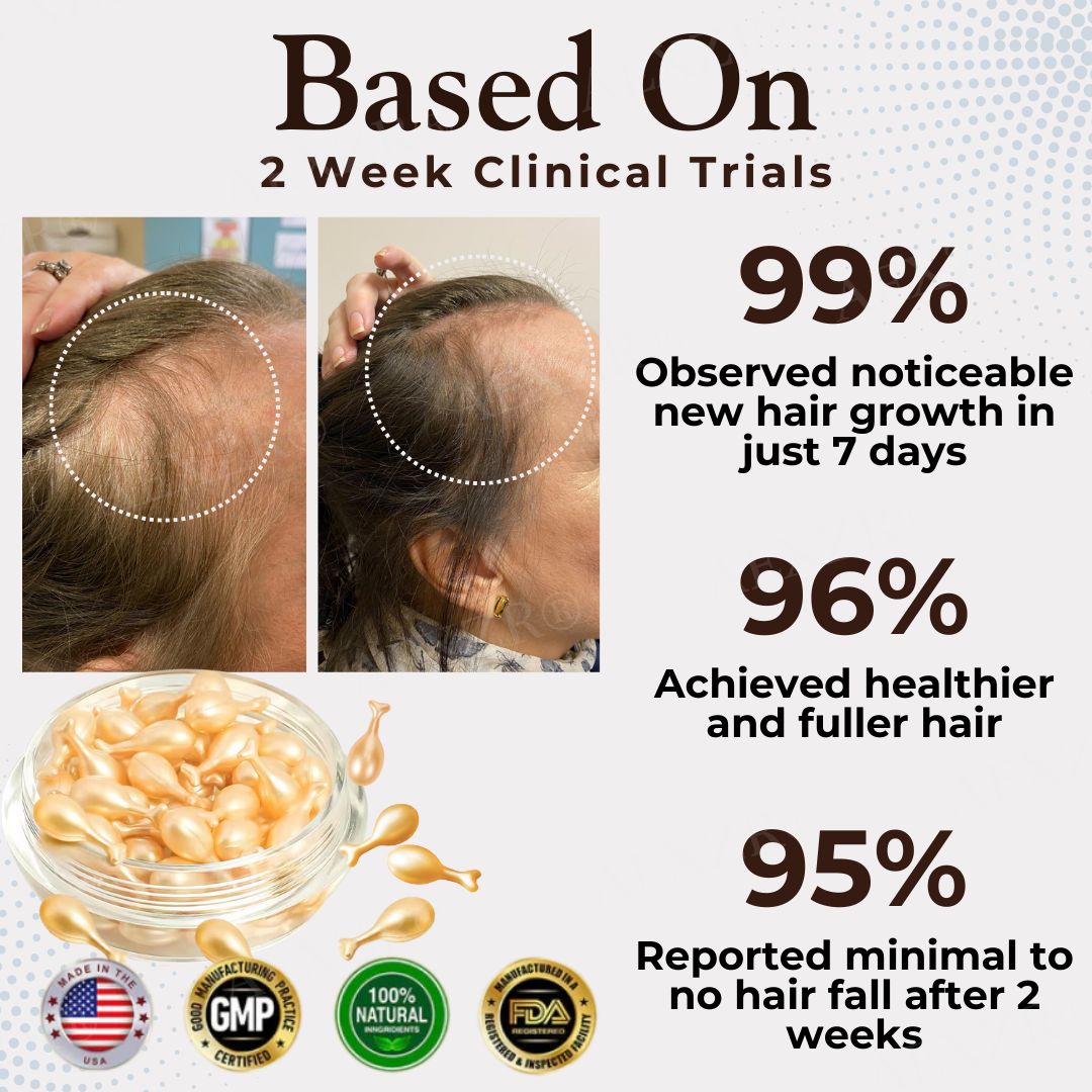 AEXZR® Hair Regrowth Capsules - LIMITED-TIME OFFER | No More Hair loss now!💕