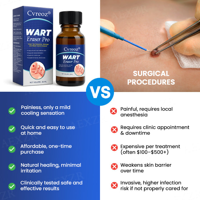 🔥Warts No More - 50% OFF | Cvreoz® Wart Eraser Pro