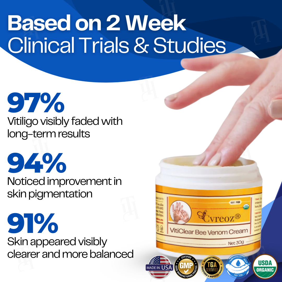 Cvreoz® VitiClear Bee Venom Cream | No More Hiding that Skin!💕