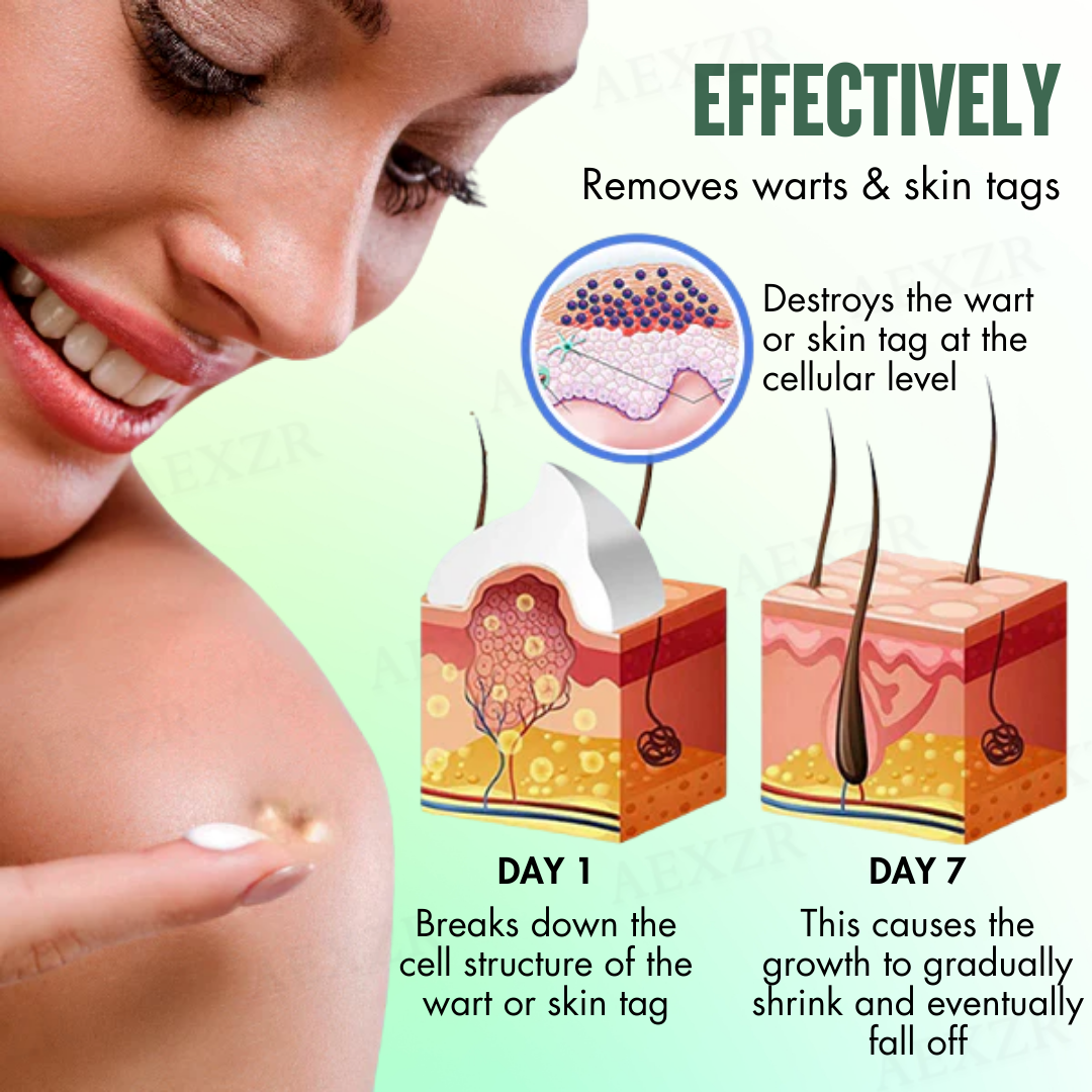 🌟 Official Store | AEXZR® WartsOff Instant Blemish Removal Cream | 50% LIMITED DISCOUNT OFFER✨
