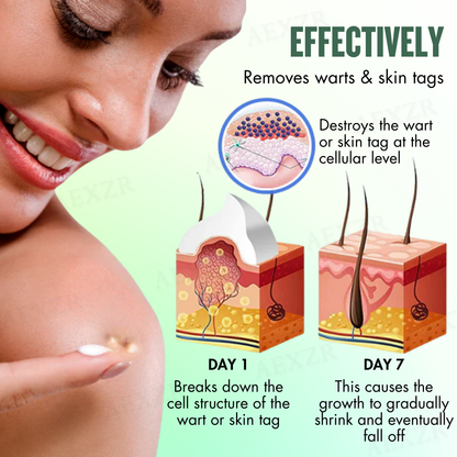 🌟 Official Store | AEXZR® WartsOff Instant Blemish Removal Cream | 50% LIMITED DISCOUNT OFFER✨