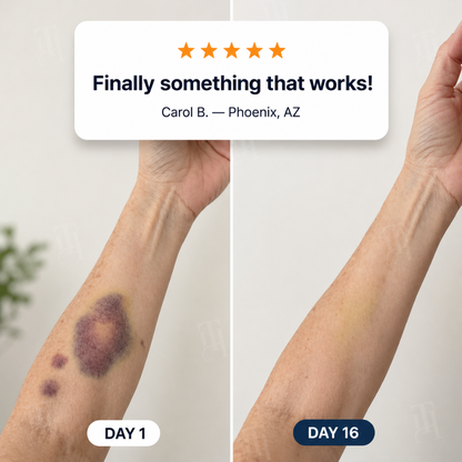 ⚡FLASH SALE !!! First 50 Get 70% OFF! | AEXZR® Bruise Repair + SPF 30 Skin-Strengthening Cream