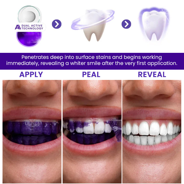 🔥LOWEST PRICE - 50% OFF | AEXZR® V34 Whitening Strips