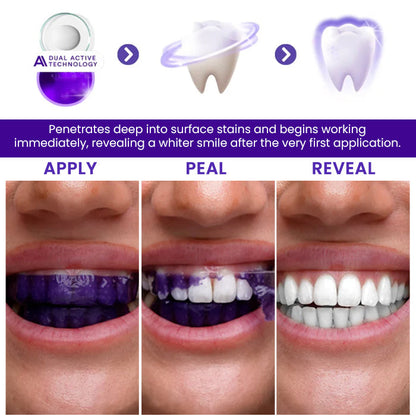 🔥LOWEST PRICE - 50% OFF | AEXZR® V34 Whitening Strips
