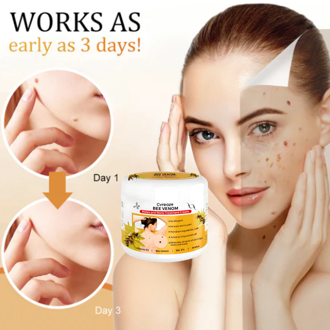 Cvreoz® Bee Venom Mole and Wart Treatment Cream - LIMITED-TIME OFFER | Let out the Best Confidence in YOU!💕