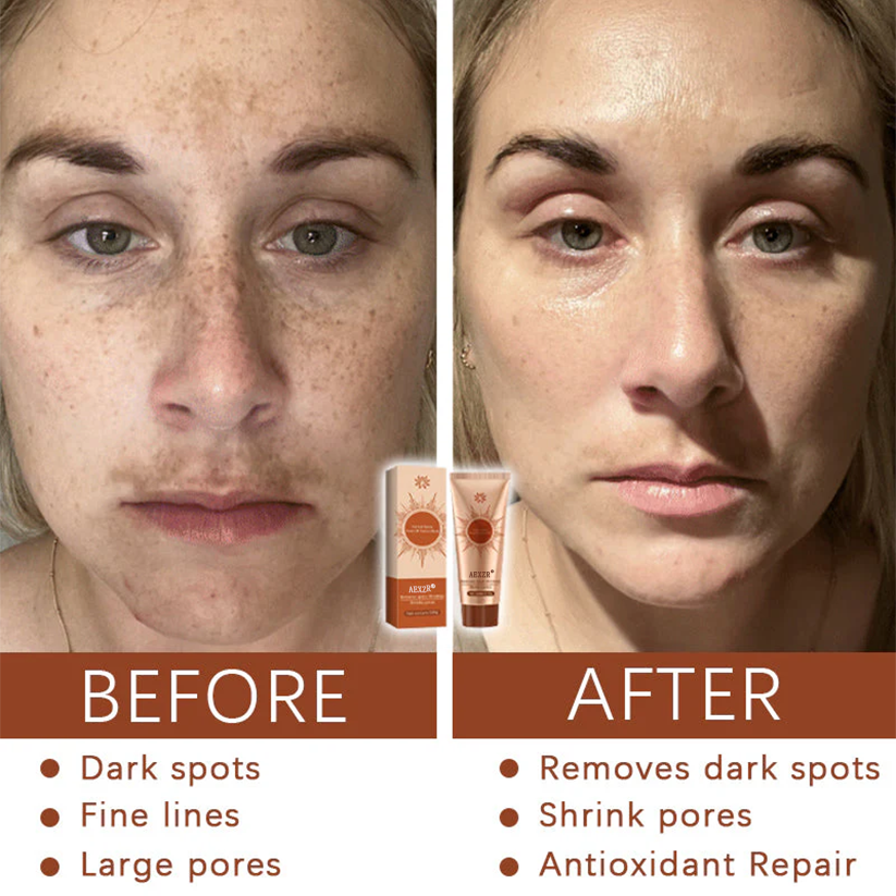 ✨LOWEST PRICE UP TO 50% OFF ✨| AEXZR® Herbal Spots Peel-Off Facial Mask