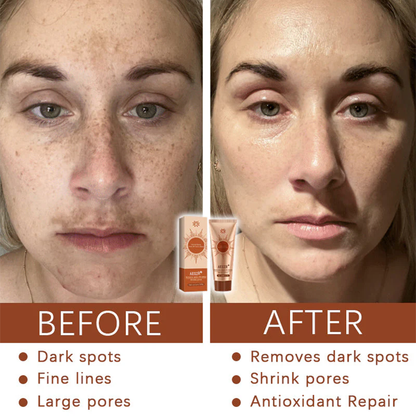 AEXZR® Herbal Spots Peel-Off Facial Mask | LIMITED DISCOUNT OFFER✨